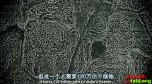 BBC人体奥妙之细胞的暗战